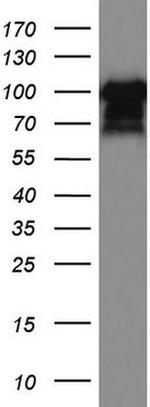 MCAM Antibody in Western Blot (WB)