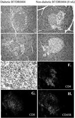 CD8 alpha Antibody in Immunohistochemistry (Frozen) (IHC (F))