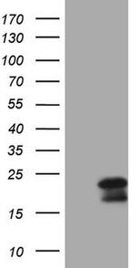 MCEE Antibody in Western Blot (WB)