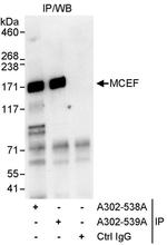 MCEF Antibody in Immunoprecipitation (IP)