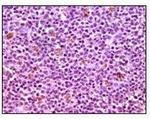 MCL-1 Antibody in Immunohistochemistry (Paraffin) (IHC (P))