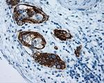 MCL1 Antibody in Immunohistochemistry (Paraffin) (IHC (P))