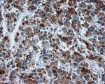 MCL1 Antibody in Immunohistochemistry (Paraffin) (IHC (P))