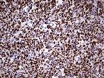 MCM2 Antibody in Immunohistochemistry (Paraffin) (IHC (P))