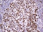 MCM2 Antibody in Immunohistochemistry (Paraffin) (IHC (P))