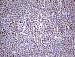 MCM2 Antibody in Immunohistochemistry (Paraffin) (IHC (P))