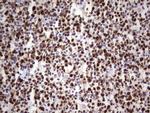 MCM2 Antibody in Immunohistochemistry (Paraffin) (IHC (P))