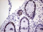 MCM2 Antibody in Immunohistochemistry (Paraffin) (IHC (P))