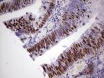 MCM2 Antibody in Immunohistochemistry (Paraffin) (IHC (P))