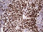 MCM2 Antibody in Immunohistochemistry (Paraffin) (IHC (P))