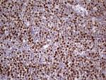 MCM2 Antibody in Immunohistochemistry (Paraffin) (IHC (P))