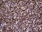 MCM2 Antibody in Immunohistochemistry (Paraffin) (IHC (P))