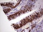 MCM2 Antibody in Immunohistochemistry (Paraffin) (IHC (P))