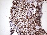 MCM2 Antibody in Immunohistochemistry (Paraffin) (IHC (P))