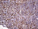 MCM2 Antibody in Immunohistochemistry (Paraffin) (IHC (P))