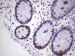 MCM2 Antibody in Immunohistochemistry (Paraffin) (IHC (P))