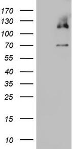 MCM2 Antibody in Western Blot (WB)