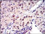 MCM2 Antibody in Immunohistochemistry (Paraffin) (IHC (P))