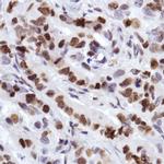 MCM2 Antibody in Immunohistochemistry (Paraffin) (IHC (P))