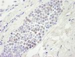 MCM4 Antibody in Immunohistochemistry (IHC)