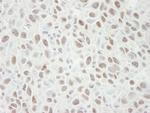 MCM4 Antibody in Immunohistochemistry (IHC)