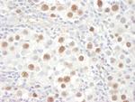 MCM4 Antibody in Immunohistochemistry (IHC)