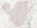 MCM4 Antibody in Immunohistochemistry (IHC)