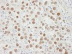 MCM5 Antibody in Immunohistochemistry (IHC)