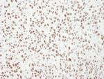 MCM6 Antibody in Immunohistochemistry (IHC)