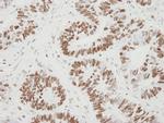 MCM6 Antibody in Immunohistochemistry (IHC)