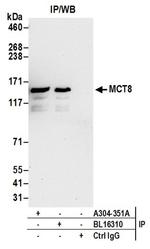 MCT8 Antibody in Western Blot (WB)