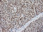 MCTS1 Antibody in Immunohistochemistry (Paraffin) (IHC (P))