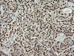 MCTS1 Antibody in Immunohistochemistry (Paraffin) (IHC (P))