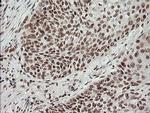 MCTS1 Antibody in Immunohistochemistry (Paraffin) (IHC (P))