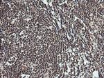 MCTS1 Antibody in Immunohistochemistry (Paraffin) (IHC (P))