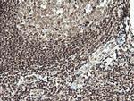 MCTS1 Antibody in Immunohistochemistry (Paraffin) (IHC (P))