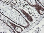 MCTS1 Antibody in Immunohistochemistry (Paraffin) (IHC (P))