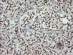 MCTS1 Antibody in Immunohistochemistry (Paraffin) (IHC (P))