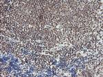 MCTS1 Antibody in Immunohistochemistry (Paraffin) (IHC (P))