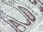 MCTS1 Antibody in Immunohistochemistry (Paraffin) (IHC (P))