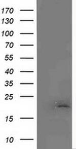 MCTS1 Antibody in Western Blot (WB)