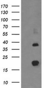 MCTS1 Antibody in Western Blot (WB)