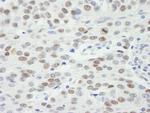 MDC1 Antibody in Immunohistochemistry (IHC)