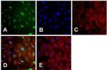 MDM2 Antibody in Immunocytochemistry (ICC/IF)