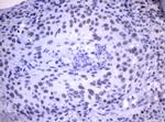 MDM2 Antibody in Immunohistochemistry (Paraffin) (IHC (P))