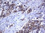 MDM2 Antibody in Immunohistochemistry (Paraffin) (IHC (P))