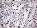 MDM2 Antibody in Immunohistochemistry (Paraffin) (IHC (P))