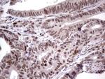 MDM2 Antibody in Immunohistochemistry (Paraffin) (IHC (P))