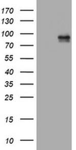 MDM2 Antibody in Western Blot (WB)