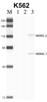 MDM2 Antibody in Immunoprecipitation (IP)